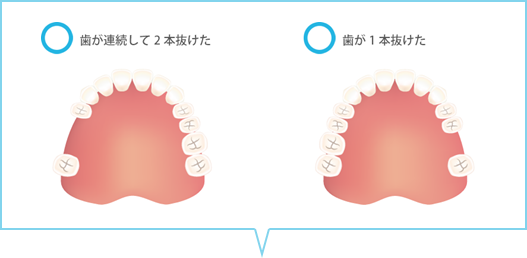 千葉県市原市ちはら台の歯医者 よこた歯科 矯正歯科クリニック コンフォート義歯