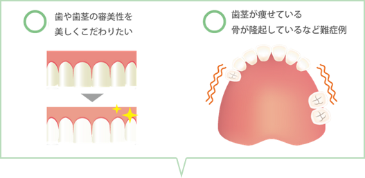 千葉県市原市ちはら台の歯医者 よこた歯科 矯正歯科クリニック コンフォート義歯