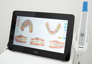 3D光学スキャナーによる矯正治療シミュレーション