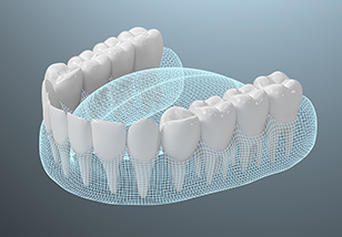 独自開発の素材と3Dデザインで、精確な歯牙移動