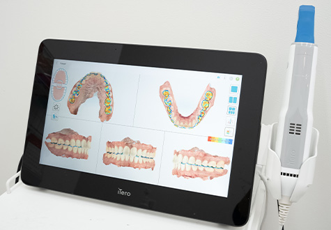矯正歯科用口腔内スキャナー
