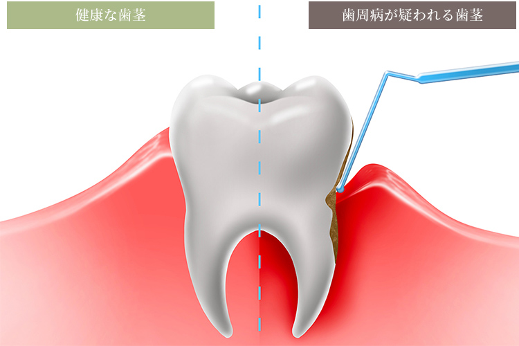 歯茎の状態を確認してみましょう